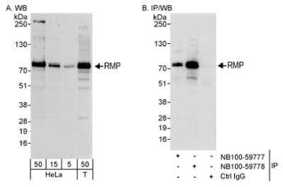 Western Blot: URI Antibody [NB100-59778] - Detection of Human RMP on HeLa whole cell lysate (5, 15, and 50 microgram) and 293T (50 microgram) using NB100-59778. RMP was also immunoprecipitated by rabbit anti-RMP antibody NB100-59777.