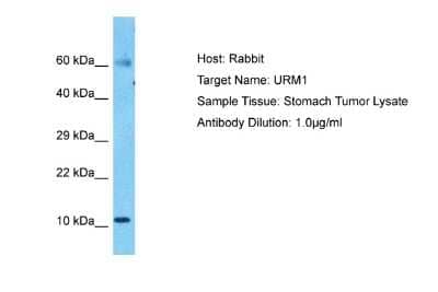 Western Blot: URM1 Antibody [NBP2-88559] - Host: Rabbit. Target Name: URM1. Sample Type: Stomach Tumor lysates. Antibody Dilution: 1.0ug/ml