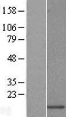 Western Blot: URM1 Overexpression Lysate (Adult Normal) [NBL1-17633] Left-Empty vector transfected control cell lysate (HEK293 cell lysate); Right -Over-expression Lysate for URM1.