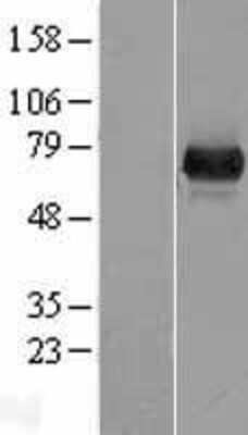 Western Blot: UROC1 Overexpression Lysate (Adult Normal) [NBP2-05551] Left-Empty vector transfected control cell lysate (HEK293 cell lysate); Right -Over-expression Lysate for UROC1.