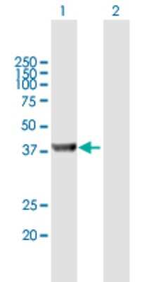 Western Blot: UROD Antibody [H00007389-B02P] - Analysis of UROD expression in transfected 293T cell line by UROD polyclonal antibody.  Lane 1: UROD transfected lysate(40.37 KDa). Lane 2: Non-transfected lysate.