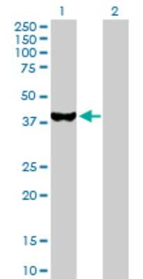 Western Blot: UROD Antibody [H00007389-D01P] - Analysis of UROD expression in transfected 293T cell line by UROD polyclonal antibody.Lane 1: UROD transfected lysate(40.80 KDa).Lane 2: Non-transfected lysate.