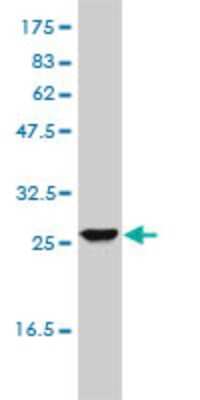 Western Blot: UROS Antibody (1E11-B11) [H00007390-M01] - UROS monoclonal antibody (M01), clone 1E11-B11 Analysis of UROS expression in HL-60.