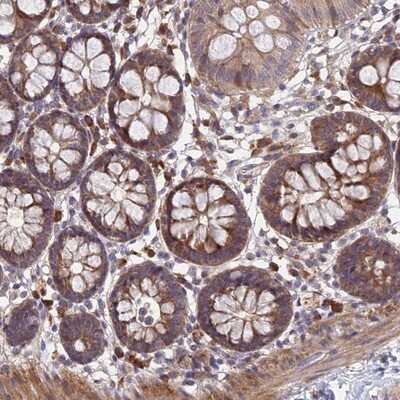 Immunohistochemistry-Paraffin UROS Antibody