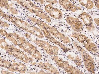 Immunohistochemistry-Paraffin: UROS Antibody [NBP2-97299] - Immunochemical staining of human UROS in human stomach with rabbit polyclonal antibody at 1:100 dilution, formalin-fixed paraffin embedded sections.