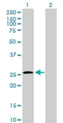 Western Blot: UROS Antibody [H00007390-B01P] - Analysis of UROS expression in transfected 293T cell line by UROS polyclonal antibody.  Lane 1: UROS transfected lysate(29.15 KDa). Lane 2: Non-transfected lysate.