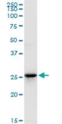 Western Blot: UROS Antibody [H00007390-D01P] - Analysis of UROS expression in MCF-7.