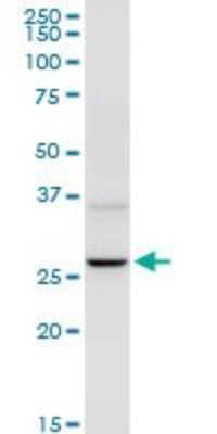 Western Blot: UROS Antibody [H00007390-D01P] - Analysis of UROS expression in mouse testis.