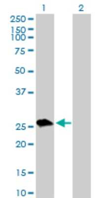 Western Blot: UROS Antibody [H00007390-D01P] - Analysis of UROS expression in transfected 293T cell line by UROS polyclonal antibody.Lane 1: UROS transfected lysate(28.60 KDa).Lane 2: Non-transfected lysate.