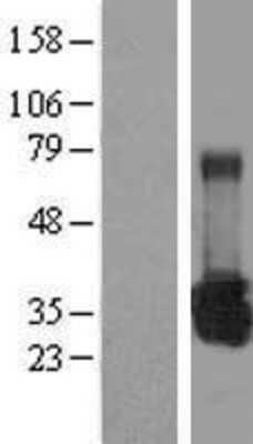 Western Blot: UROS Overexpression Lysate (Adult Normal) [NBL1-17635] Left-Empty vector transfected control cell lysate (HEK293 cell lysate); Right -Over-expression Lysate for UROS.