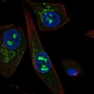 Immunocytochemistry/Immunofluorescence: USAG1/SOSTDC1 Antibody [NBP3-17959] - Staining of human cell line RPTEC TERT1 shows localization to nucleoli rim & the Golgi apparatus.