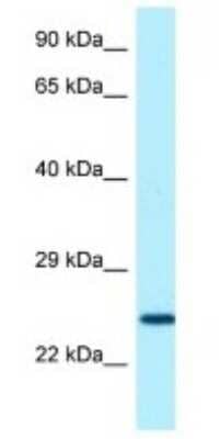 Western Blot: USAG1/SOSTDC1 Antibody [NBP1-98525] - Human Fetal Heart Lysate, concentration 1 ug/ml.