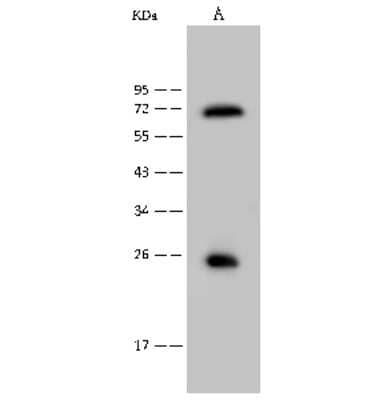 Western Blot: USAG1/SOSTDC1 Antibody [NBP2-99425] - Anti-USAG1/SOSTDC1 rabbit polyclonal antibody at 1:500 dilution. Lane A: Mouse liver tissue lysate Lysates/proteins at 30 ug per lane. Secondary Goat Anti-Rabbit IgG (H+L)/HRP at 1/10000 dilution. Developed using the ECL technique. Performed under reducing conditions. Predicted band size: 23 kDa. Observed band size: 25 kDa