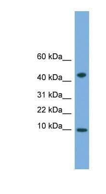 Western Blot: USMG5 Antibody [NBP1-91361] - Human Heart lysate, concentration 0.2-1 ug/ml.