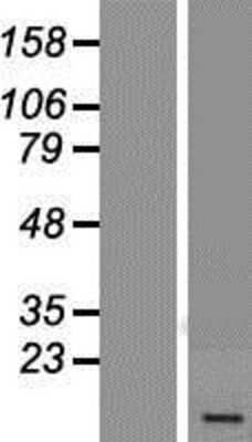 Western Blot: USMG5 Overexpression Lysate (Adult Normal) [NBP2-05974] Left-Empty vector transfected control cell lysate (HEK293 cell lysate); Right -Over-expression Lysate for USMG5.