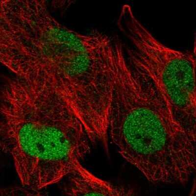 <b>Independent Antibodies Validation. </b>Immunocytochemistry/Immunofluorescence: USP1 Antibody [NBP2-55036] - Staining of human cell line U-251 MG shows localization to nucleoplasm.