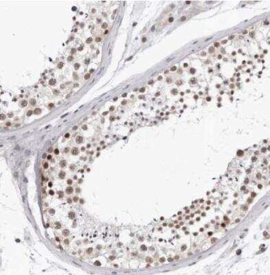 Immunohistochemistry-Paraffin: USP1 Antibody [NBP1-85950] - Staining of human testis shows moderate nuclear positivity in cells in seminiferious ducts.