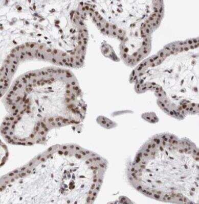 Immunohistochemistry-Paraffin: USP1 Antibody [NBP1-85950] - Staining of human placenta shows strong nuclear positivity in trophoblastic cells.