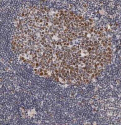 Immunohistochemistry-Paraffin: USP1 Antibody [NBP1-85950] - Staining of human lymph node shows strong nuclear positivity in germinal center cells.