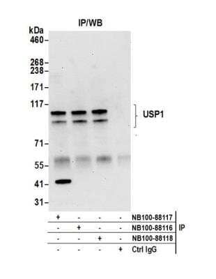 <b>Independent Antibodies Validation. </b>Immunoprecipitation: USP1 Antibody [NB100-88117] - Detection of human USP1 by western blot of immunoprecipitates. Samples: Whole cell lysate (0.5 or 1.0 mg per IP reaction; 20% of IP loaded) from HeLa cells prepared using NETN lysis buffer. Antibodies: Affinity purified rabbit anti-USP1 antibody NB100-88117 used for IP at 6 ug per reaction. USP1 was also immunoprecipitated by rabbit anti-USP1 antibodies NB100-88116 and NB100-88118. For blotting immunoprecipitated USP1, NB100-88117 was used at 1 ug/ml. Detection: Chemiluminescence with an exposure time of 30 seconds.