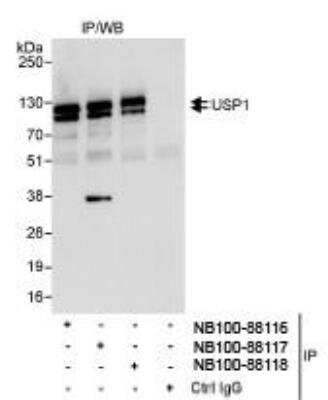 Immunoprecipitation: USP1 Antibody [NB100-88118] - WB of Immunoprecipitates. Whole cell lysate (1 mg for IP, 20% of IP loaded) from HeLa cells. Affinity purified rabbit anti-USP1 antibody NB100-88118 used for IP at 3 mcg/mg lysate. USP1 was also immunoprecipitated by rabbit anti-USP1 antibodies NB100-88116 and NB100-88117, which recognize upstream epitopes.