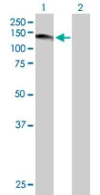 Western Blot: USP1 Antibody [H00007398-B01P] - Analysis of USP1 expression in transfected 293T cell line by USP1 polyclonal antibody.  Lane 1: USP1 transfected lysate(86.35 KDa). Lane 2: Non-transfected lysate.