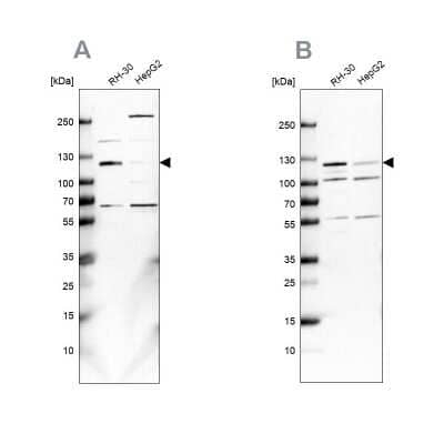 Western Blot: USP1 Antibody [NBP2-55036] - Analysis using Anti-USP1 antibody NBP2-55036 (A) shows similar pattern to independent antibody NBP1-85950 (B).