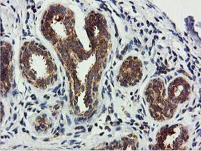 Immunohistochemistry-Paraffin: USP10 Antibody (2E1) [NBP2-01452] - Staining of paraffin-embedded Human breast tissue using anti-USP10 mouse monoclonal antibody.