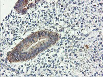 Immunohistochemistry-Paraffin: USP10 Antibody (2E1) [NBP2-01452] - Staining of paraffin-embedded Human endometrium tissue using anti-USP10 mouse monoclonal antibody.