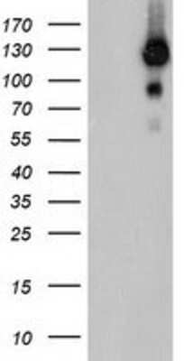 Western Blot: USP10 Antibody (2E1) [NBP2-01452] - HEK293T cells were transfected with the pCMV6-ENTRY control (Left lane) or pCMV6-ENTRY USP10 (Right lane) cDNA for 48 hrs and lysed. Equivalent amounts of cell lysates (5 ug per lane) were separated by SDS-PAGE and immunoblotted with anti-USP10.