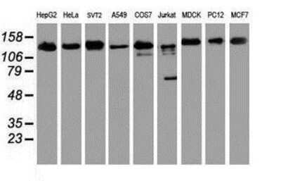 Western Blot: USP10 Antibody (2E1) [NBP2-01452] Analysis of extracts (35ug) from 9 different cell lines by using anti-USP10 monoclonal antibody.