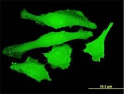 Immunocytochemistry/Immunofluorescence: USP10 Antibody (3B8) [H00009100-M01] - Analysis of monoclonal antibody to USP10 on HeLa cell . Antibody concentration 10 ug/ml.