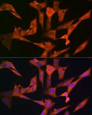 Immunocytochemistry/Immunofluorescence: USP10 Antibody (9L6F3) [NBP3-16416] - Immunofluorescence analysis of NIH-3T3 cells using USP10 Rabbit mAb (NBP3-16416) at dilution of 1:100 (40x lens). Blue: DAPI for nuclear staining.