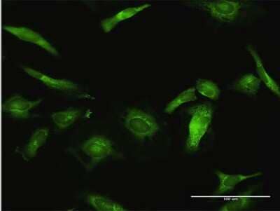 Immunocytochemistry/Immunofluorescence: USP10 Antibody [H00009100-D01P] - Analysis of antibody to USP10 on HeLa cell. Antibody concentration 10 ug/ml.