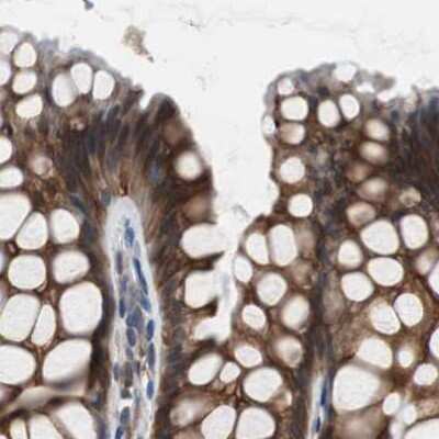 Immunohistochemistry-Paraffin: USP10 Antibody [NBP1-83028] - Staining of human colon.