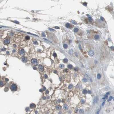 Immunohistochemistry-Paraffin: USP10 Antibody [NBP1-83028] - Staining of human testis.