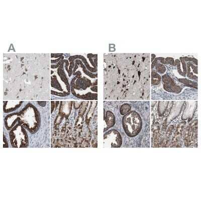 <b>Independent Antibodies Validation. </b>Immunohistochemistry-Paraffin: USP10 Antibody [NBP1-83028] - Staining of human cerebral cortex, fallopian tube, prostate and stomach using Anti-USP10 antibody NBP1-83028 (A) shows similar protein distribution across tissues to independent antibody NBP1-83029 (B).