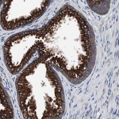 Immunohistochemistry-Paraffin: USP10 Antibody [NBP1-83028] - Staining of human prostate shows strong cytoplasmic positivity in glandular cells.