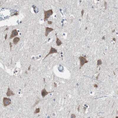 Immunohistochemistry-Paraffin: USP10 Antibody [NBP1-83028] - Staining of human cerebral cortex shows moderate cytoplasmic positivity in neurons.