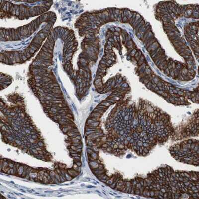 Immunohistochemistry-Paraffin: USP10 Antibody [NBP1-83028] - Staining of human Fallopian tube shows strong cytoplasmic positivity in glandular cells.