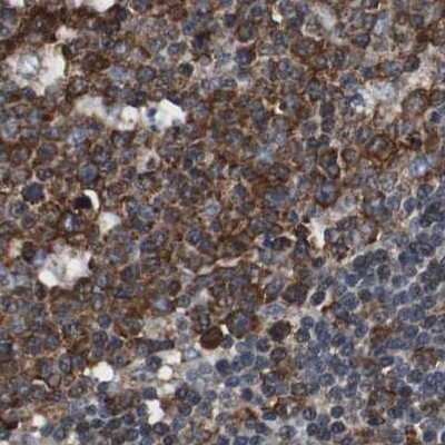 Immunohistochemistry-Paraffin: USP10 Antibody [NBP1-83029] - Staining of human lymph node.