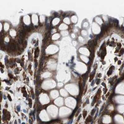 Immunohistochemistry-Paraffin: USP10 Antibody [NBP1-83029] - Staining of human colon.