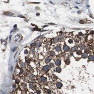 Immunohistochemistry-Paraffin: USP10 Antibody [NBP1-83029] - Staining of human testis.