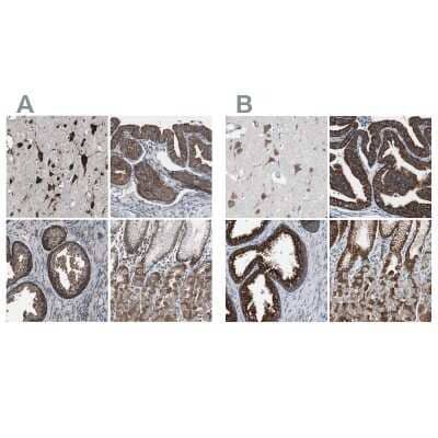 <b>Independent Antibodies Validation. </b>Immunohistochemistry-Paraffin: USP10 Antibody [NBP1-83029] - Staining of human cerebral cortex, fallopian tube, prostate and stomach using Anti-USP10 antibody NBP1-83029 (A) shows similar protein distribution across tissues to independent antibody NBP1-83028 (B).