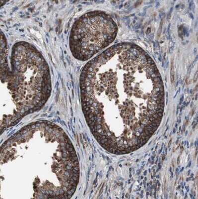 Immunohistochemistry-Paraffin: USP10 Antibody [NBP1-83029] - Staining of human prostate shows strong cytoplasmic positivity in glandular cells.