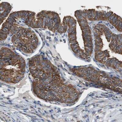 Immunohistochemistry-Paraffin: USP10 Antibody [NBP1-83029] - Staining of human Fallopian tube shows strong cytoplasmic positivity in glandular cells.