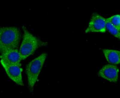 Immunocytochemistry/Immunofluorescence: USP10 Antibody (JU32-62) [NBP2-75698] - Staining USP10 in MCF-7 cells (green). The nuclear counter stain is DAPI (blue). Cells were fixed in paraformaldehyde, permeabilised with 0.25% Triton X100/PBS.