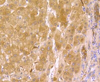 Immunohistochemistry-Paraffin: USP10 Antibody (JU32-62) [NBP2-75698] - Analysis of paraffin-embedded human liver tissue using anti-USP10 antibody. Counter stained with hematoxylin.