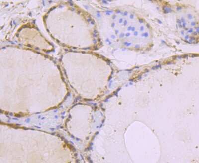 Immunohistochemistry-Paraffin: USP10 Antibody (JU32-62) [NBP2-75698] - Analysis of paraffin-embedded human thyroid grand tissue using anti-USP10 antibody. Counter stained with hematoxylin.