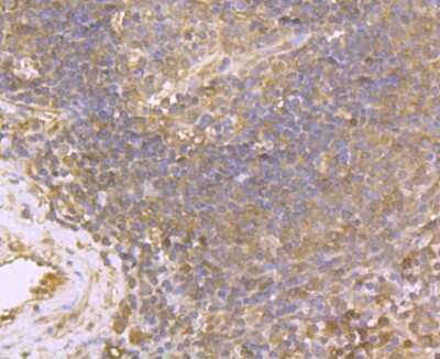 Immunohistochemistry-Paraffin: USP10 Antibody (JU32-62) [NBP2-75698] - Analysis of paraffin-embedded human spleen tissue using anti-USP10 antibody. Counter stained with hematoxylin.